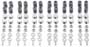 Greenline Motorsports - TODA  Inner Shim Kit